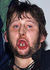 shanemacgowan1pk.jpg