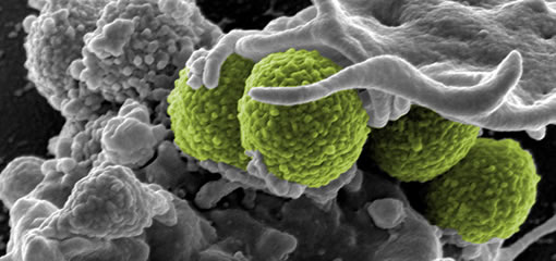 microbiology-infection.jpg