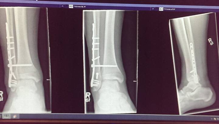 xray.jpg