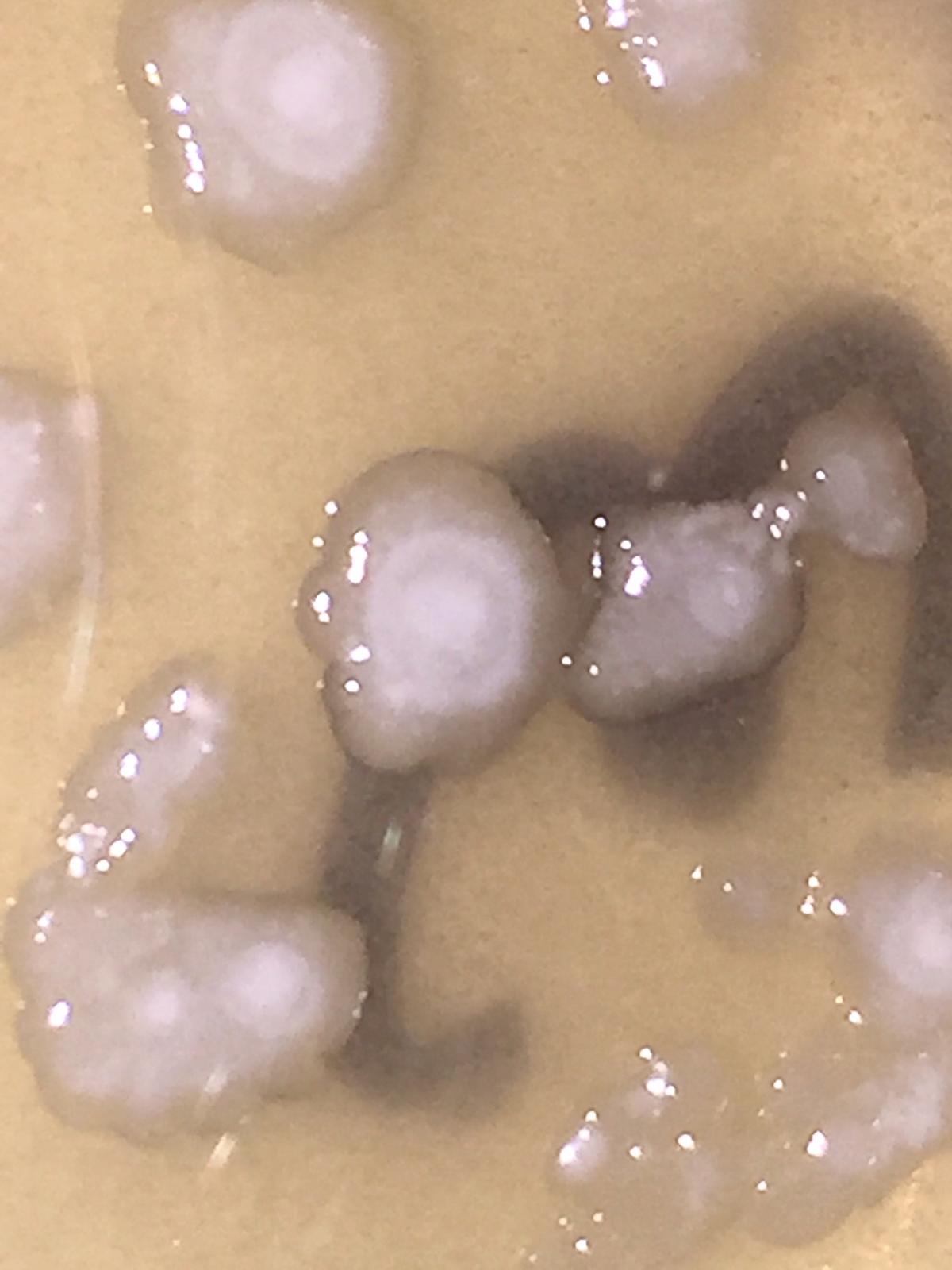 Yeast A.jpg Yeast A.jpg