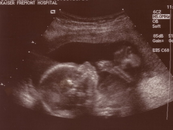 Thenextadditiontomyfamily