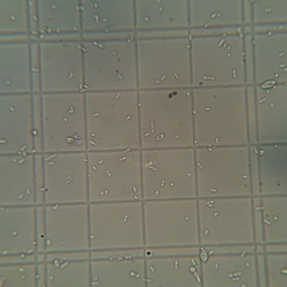 1LWyeastBrettBstarterrefrigerated6days151dilution