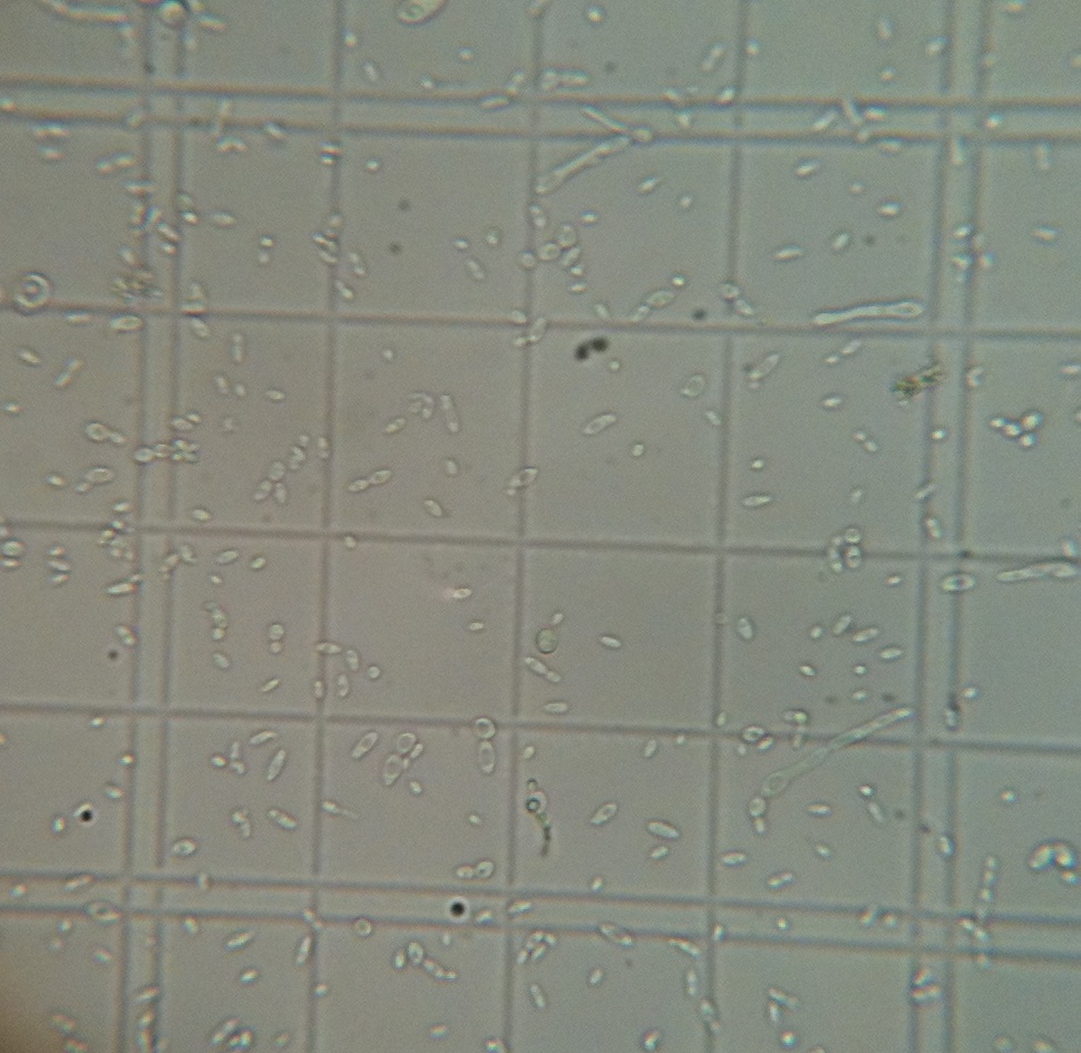 1LWyeastBrettBstarterrefrigerated6days151dilution