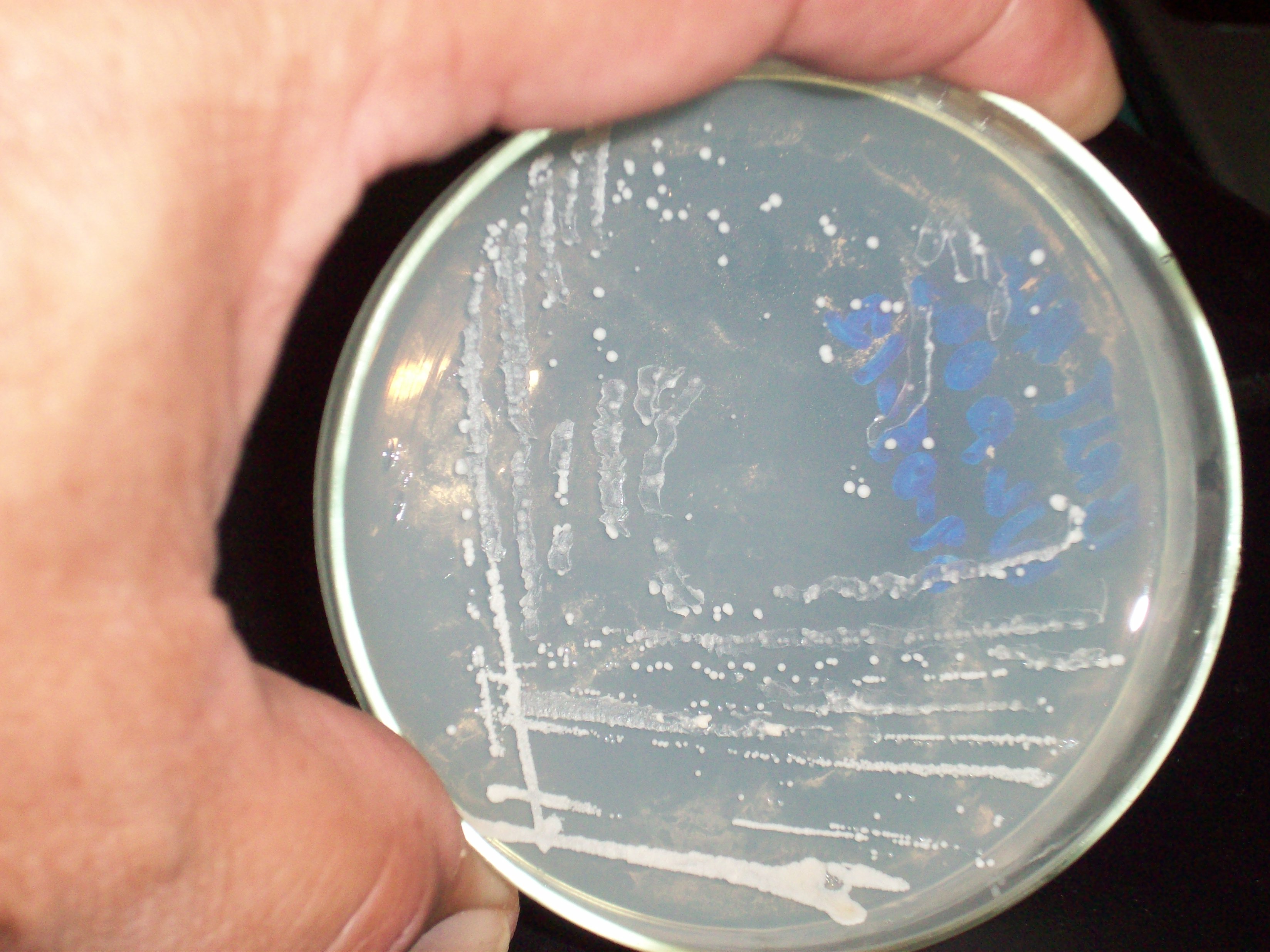 Growing Yeast