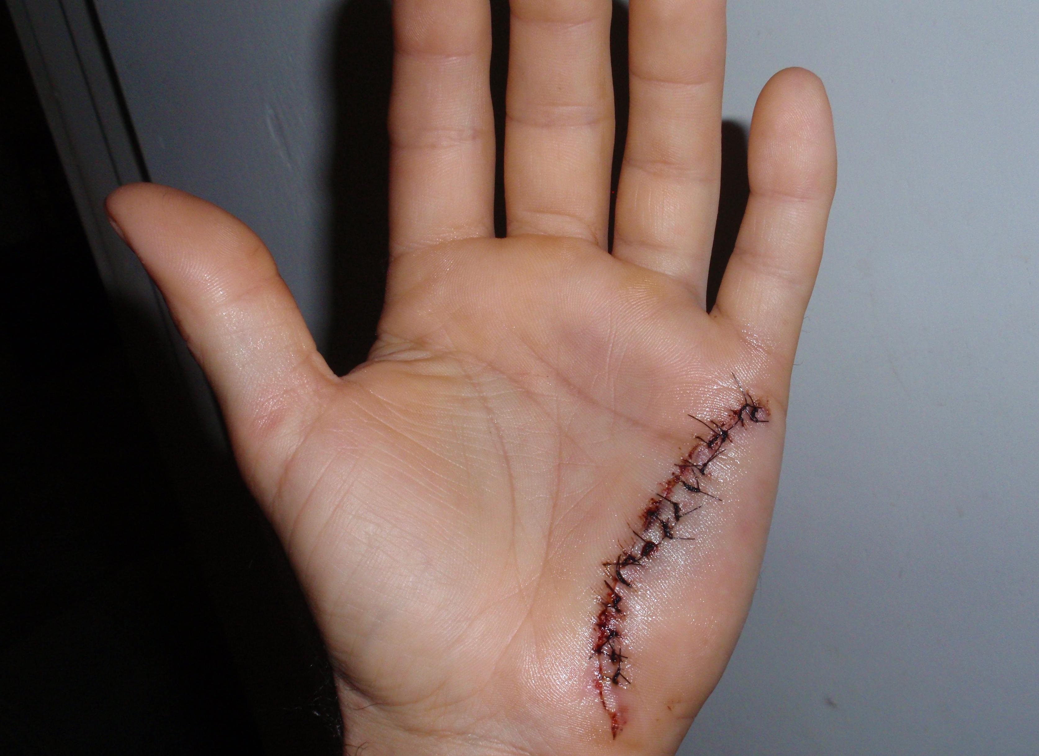 hand stitches