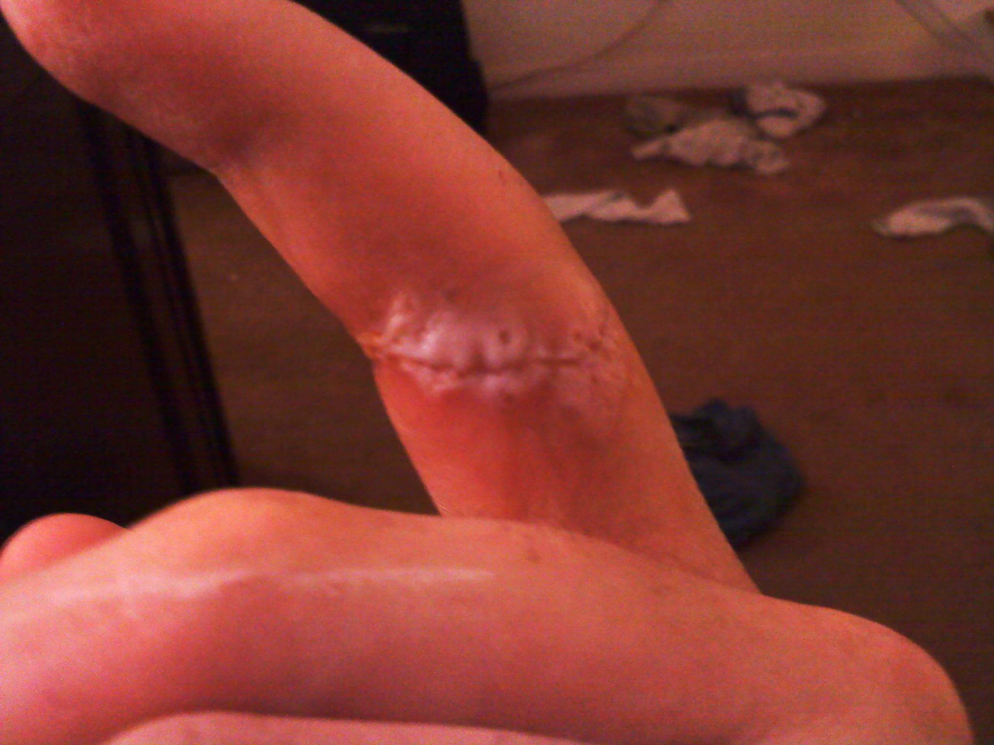 Finger
