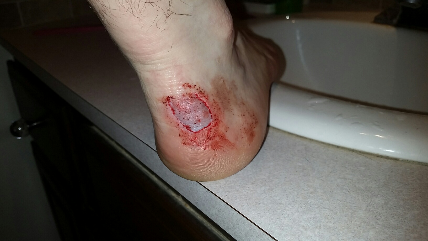 Foot_Cut_Not_Pretty.jpg