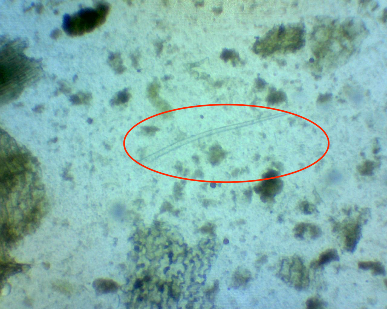 bacteria-1.jpeg bacteria-1.jpeg