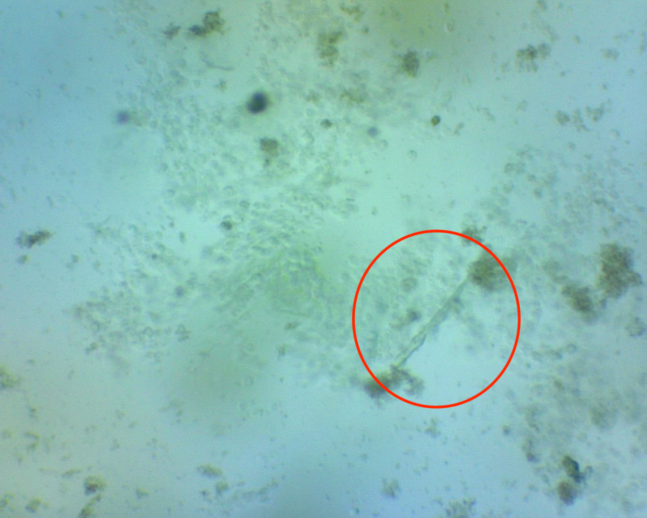 bacteria-2.jpeg bacteria-2.jpeg