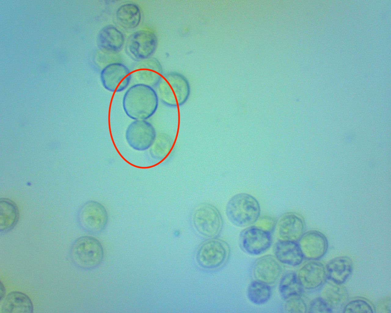mitosis.jpeg mitosis.jpeg