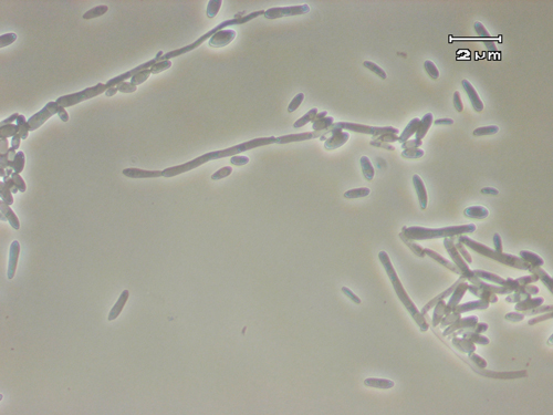 Brettanomyces.jpg