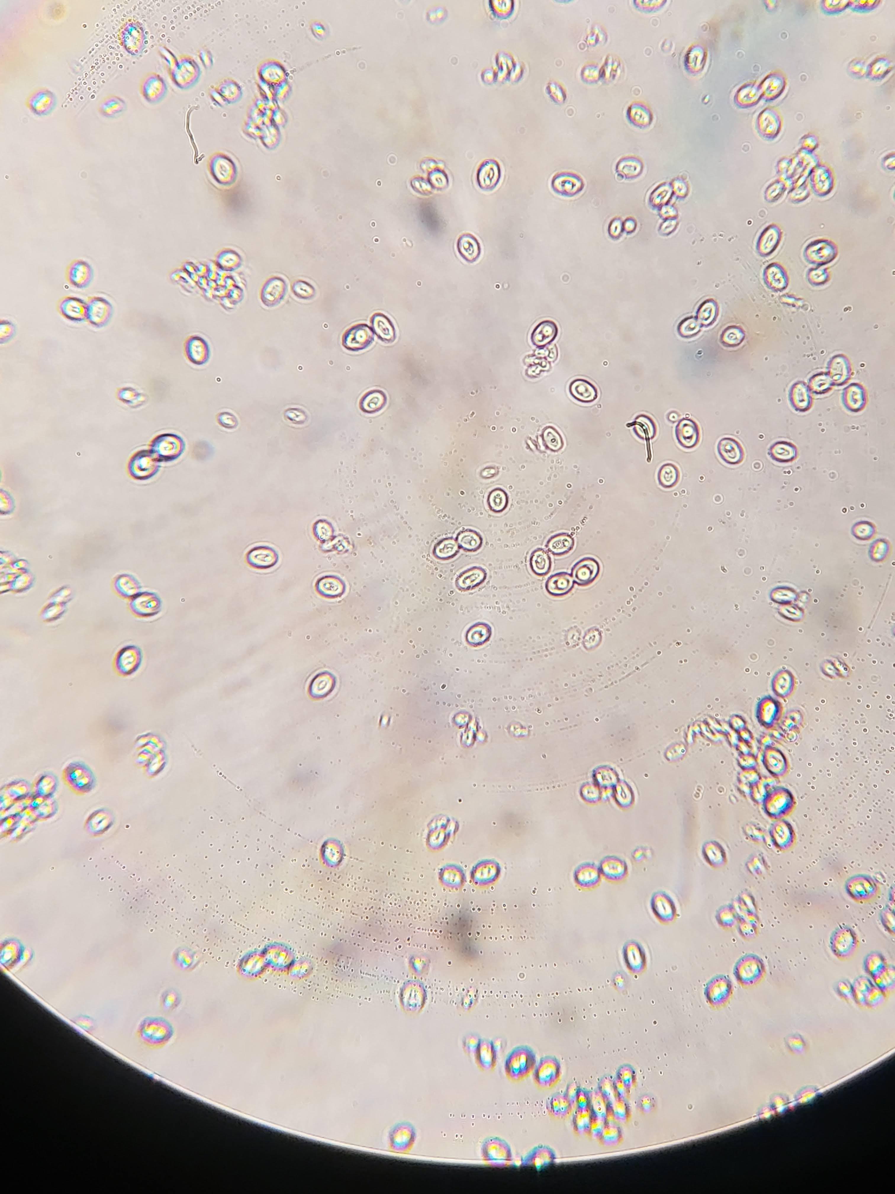 WildYeast.jpg WildYeast.jpg