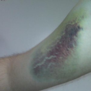arm2