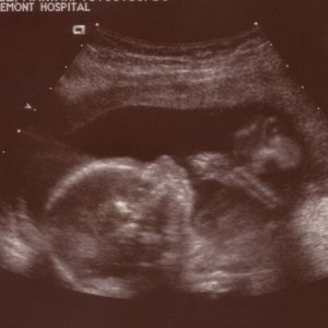 Thenextadditiontomyfamily