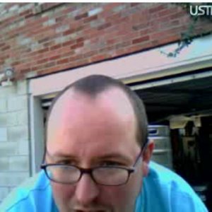 opher_forehead