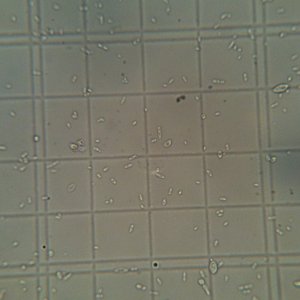 1LWyeastBrettBstarterrefrigerated6days151dilution
