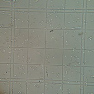 1LWyeastBrettBstarterrefrigerated6days151dilution